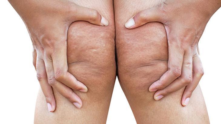 lipodem kadinlarin sessiz cigligi neden kilo veremiyorum diyenler icin cevap YtDWxcPY.jpg