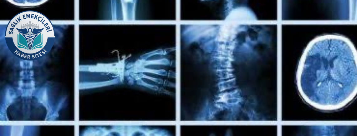 Radyoloji Skandalı İddiası: Savcılık Harekete Geçti: Yanlış Raporlar Mercek Altında! – Sağlık Emekçileri Haber Kanalı