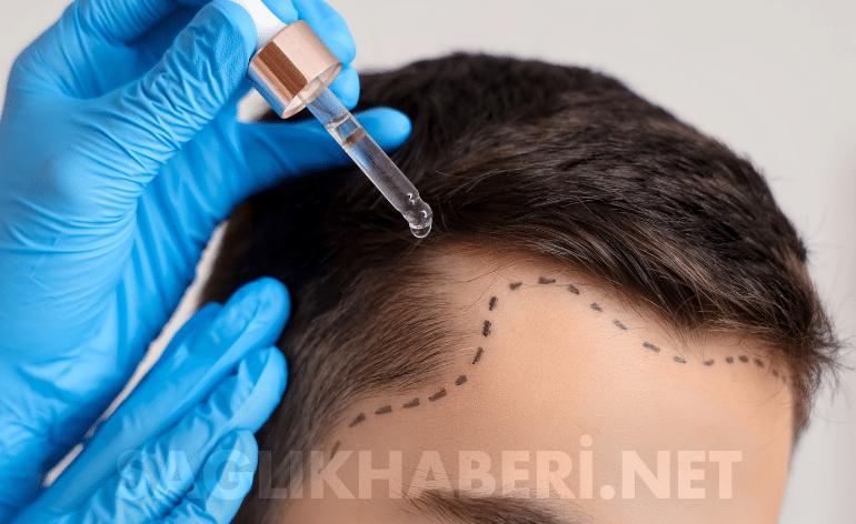 Sağlık Bakanlığı’ndan Saç Ekimi İçin Yeni Sertifika Programı: 4 Branşa Fırsat!