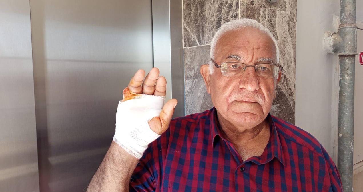 Hatay’da Şok Edici Kavga: Komşusunun Parmağını Isırarak Kopardı